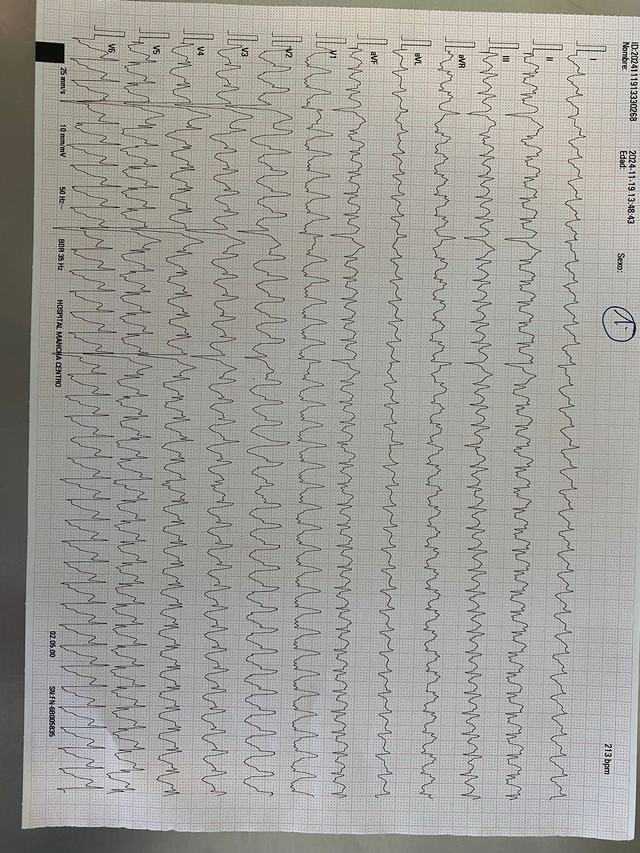 ECG: Flutter común
